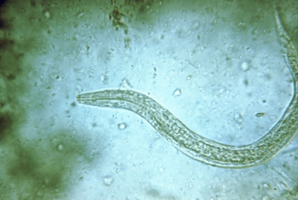 Mikrofotografie lidské měchovce (Ancylostoma duodenale a Necator americanus) rhabditiformní larva, která je jejím časným neinfekčním stádiem, 1979. Obrázek s laskavým svolením CDC.  (Foto od Smith Collection/Gado/Getty Images)